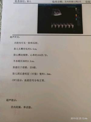 孕妇血糖6.5