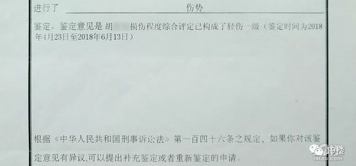 肋骨骨折司法鉴定标准