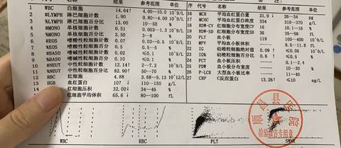 宝宝淋巴细胞数偏高