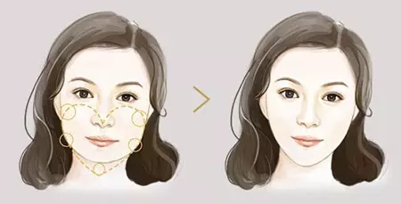 哪里可以买到瘦脸针