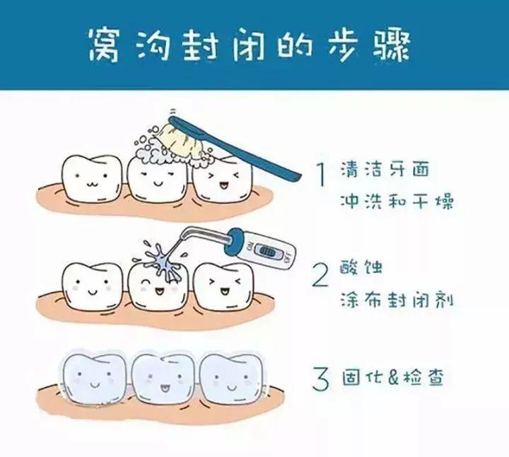 蛀牙怎么治疗