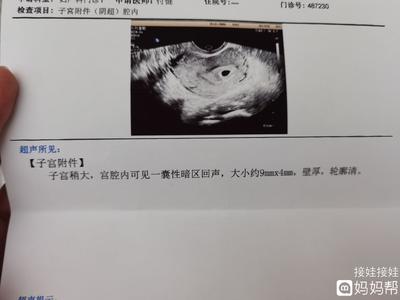 怀孕几天能看到孕囊