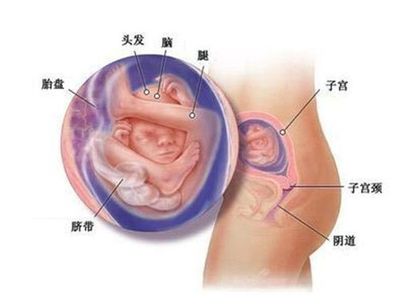 怀孕五个月稳定了吗