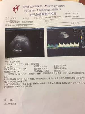 梦见孕妇羊水破了