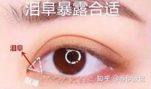 好看的内眦双眼皮