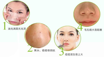 上火 痘痘 为什么