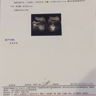 做胃镜影响怀孕吗