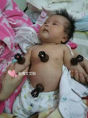 婴儿晚上咳嗽怎么办