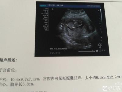 怀孕多久可见孕囊