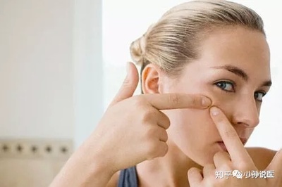 长痘痘应该怎么处理
