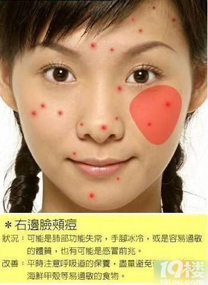 右边脸颊长痘痘是什么原因