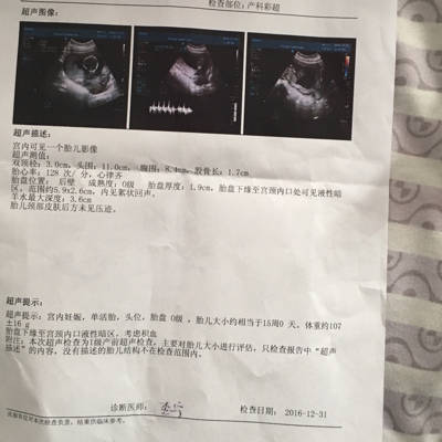 怀孕14周宝宝有多大