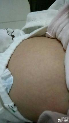 宝宝皮肤花花的图片
