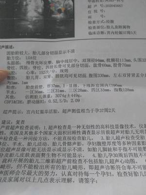怀孕可以吃嗦螺吗
