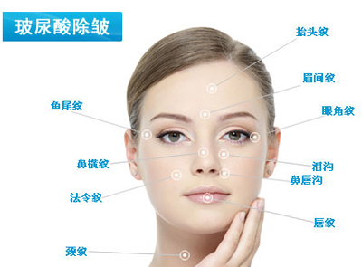 玻尿酸脸上除皱