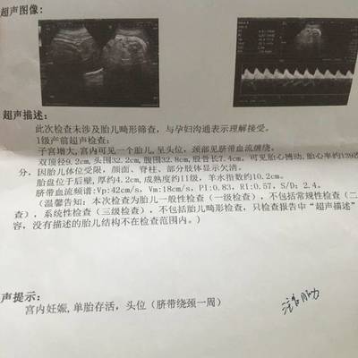 孕妇32周做什么检查