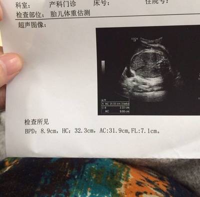 多少周估算胎儿体重