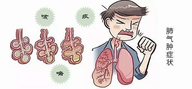 肺结节是怎么回事
