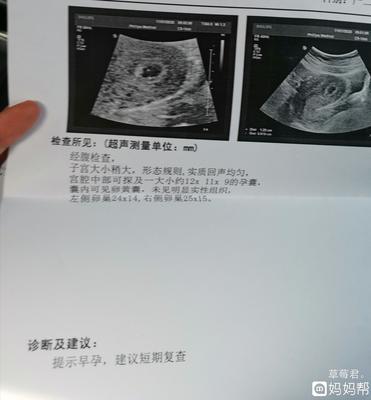 怀孕35天能看到孕囊吗