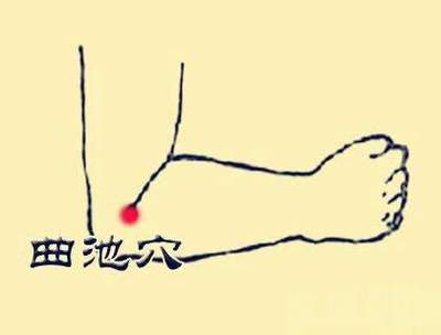 曲池疼是怎么回事