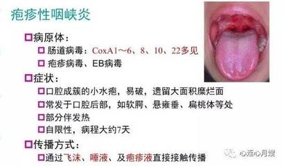 儿童手足口病怎么治疗