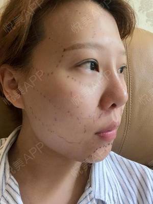 做梦洗脸