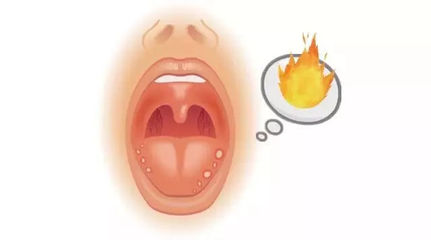 经常上火是怎么回事