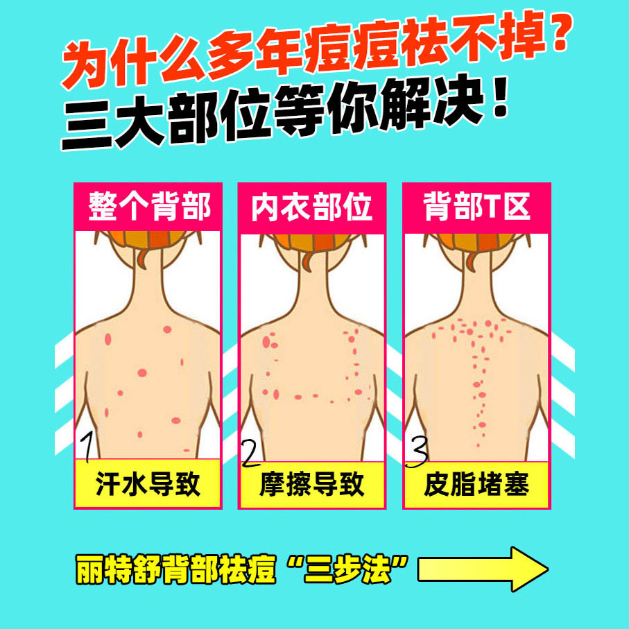 背上长痘痘用浴盐好吗