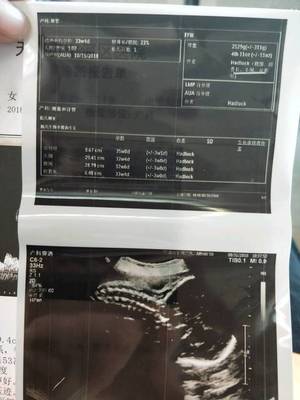 一个月双顶径能长多少