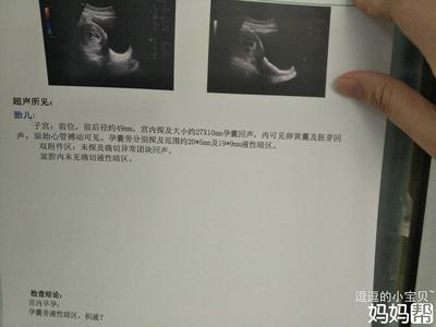 宫腔积液可以怀孕吗