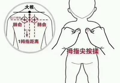 肺热咳嗽推拿