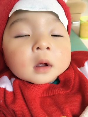 宝宝半夜发烧40度怎么办