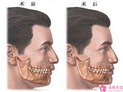 口腔内外科区别