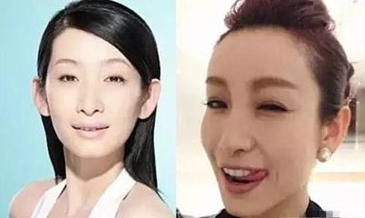 割双眼皮成功的明星