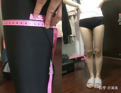 抽脂价格要多少钱