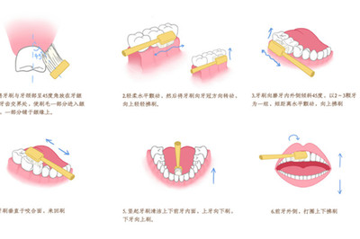 口腔出血是什么原因
