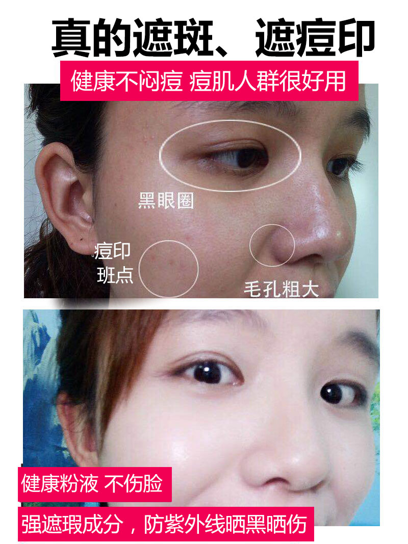 痘痘肌用什么脸部精华液