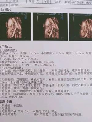 怀孕35周可以引产吗