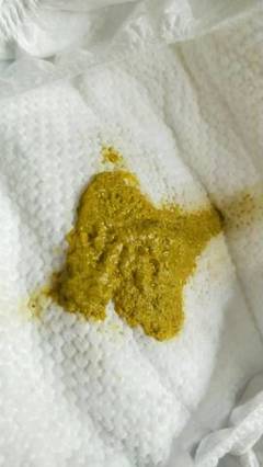 新生儿蛋花样大便