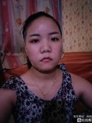 脸上突然才小痘痘