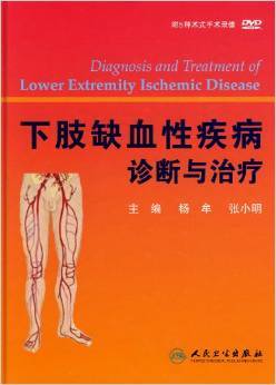 下肢缺血怎么治疗好