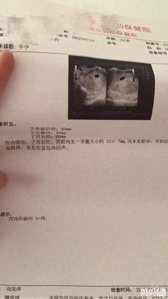 孕酮吃多了对胎儿有影响吗