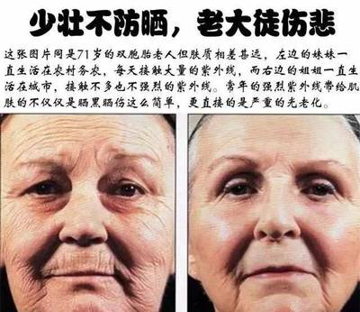 老年人适合用什么护肤品