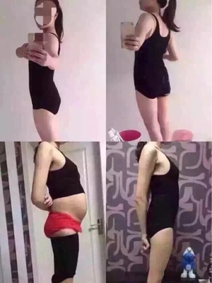 减肥肚子肉松弛怎么办