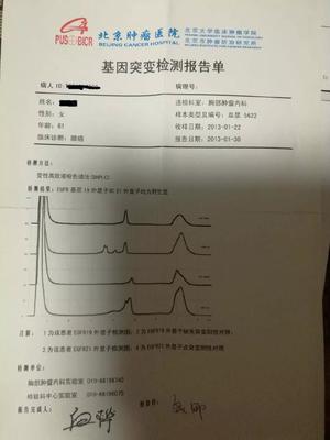 胸水报告怎么看