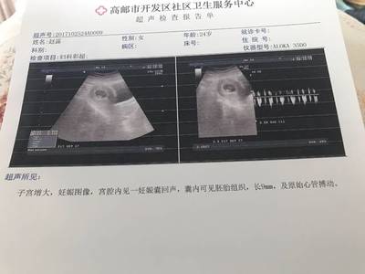 一般怀孕多久有心跳