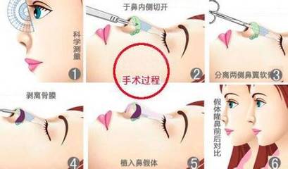 鼻翼内侧疼是怎么回事