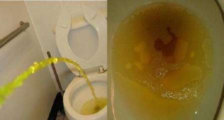 小便有白色泡沫是怎么回事