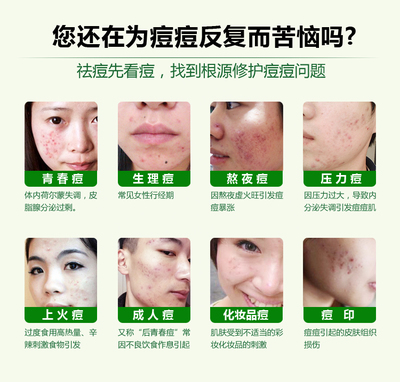痘痘反弹