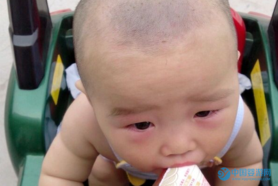 结膜炎是怎么回事
